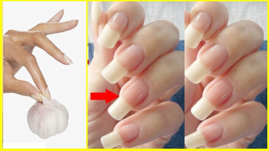 Tips to Make Your Nails Grow Faster And Stronger