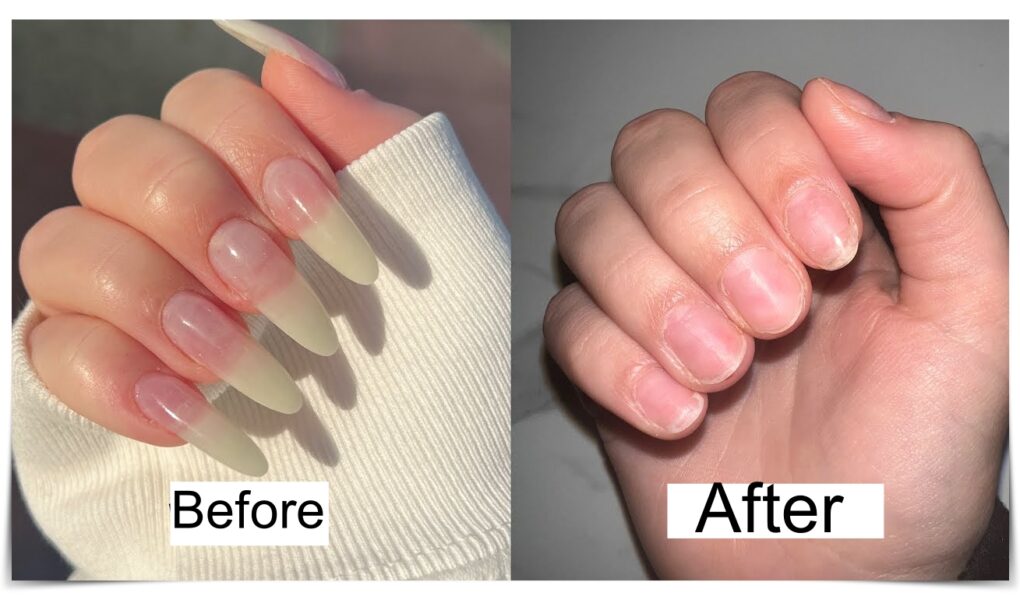 How To Remove Acrylic Nails At Home 3 steps